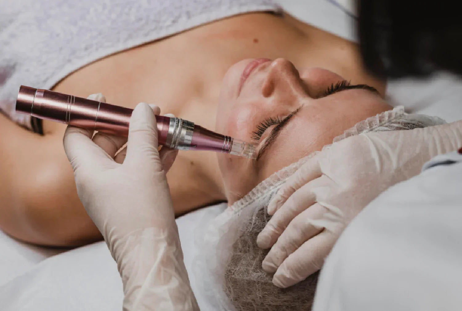 DP4 Microneedling Sessions 