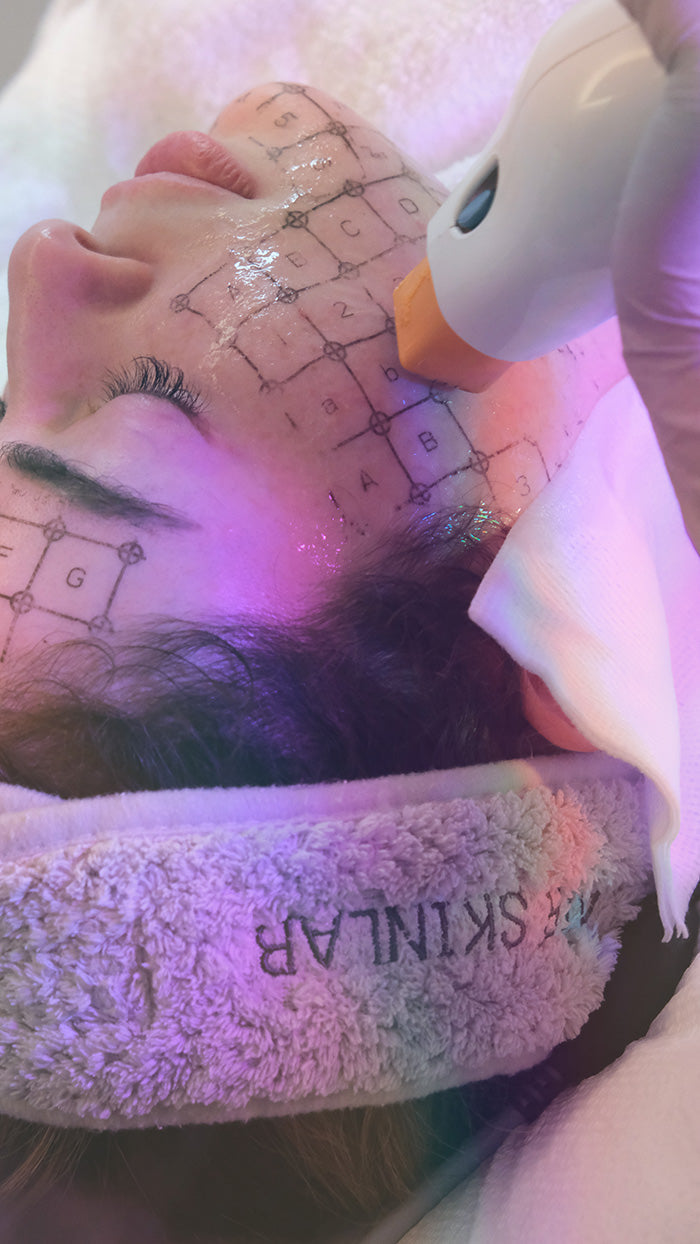 Ultherapy vs Thermage: Which Skin Tightening Treatment is Better?