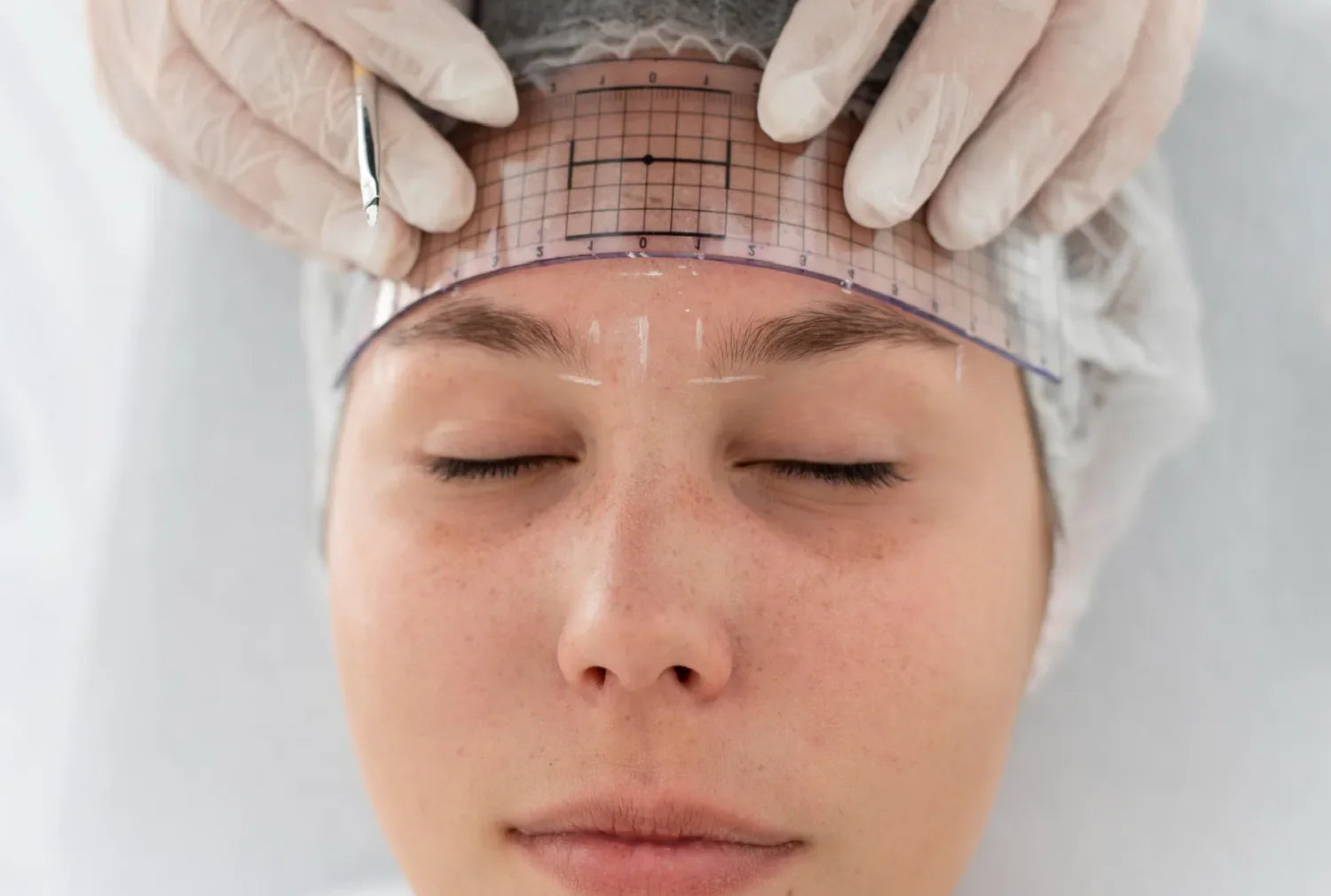 One and Done? Or More Than One? The Truth About Thread Lift Sessions