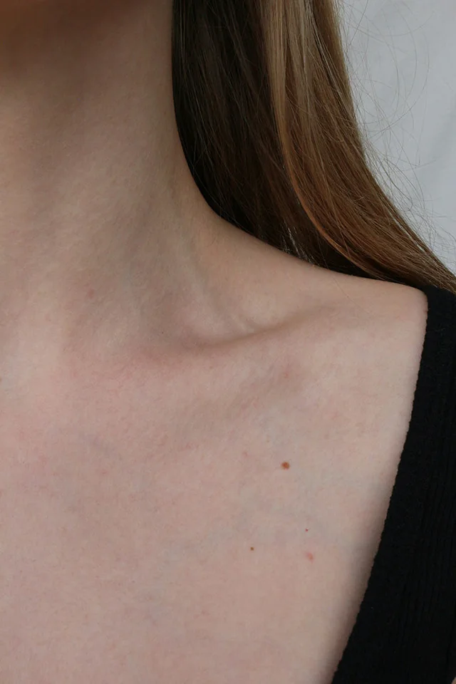 Aging Neck