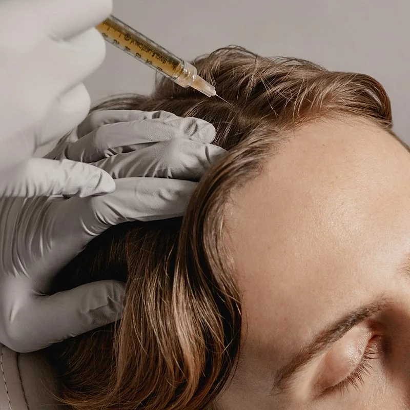 PRP [Platelet Rich Plasma]