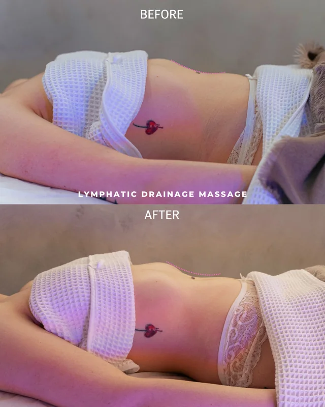 Lymphatic Drainage