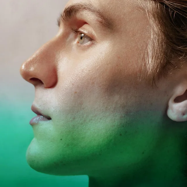 RF Microneedling
